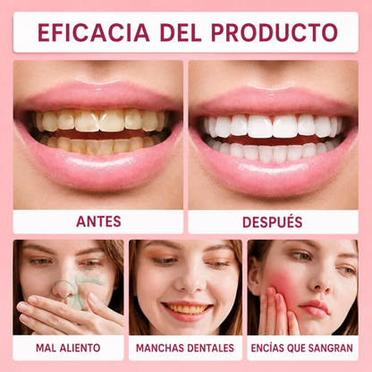 Blanqueador Dental Morada v34