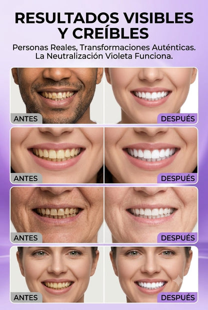 Blanqueador dental para sonrisa mas blanca y brillante